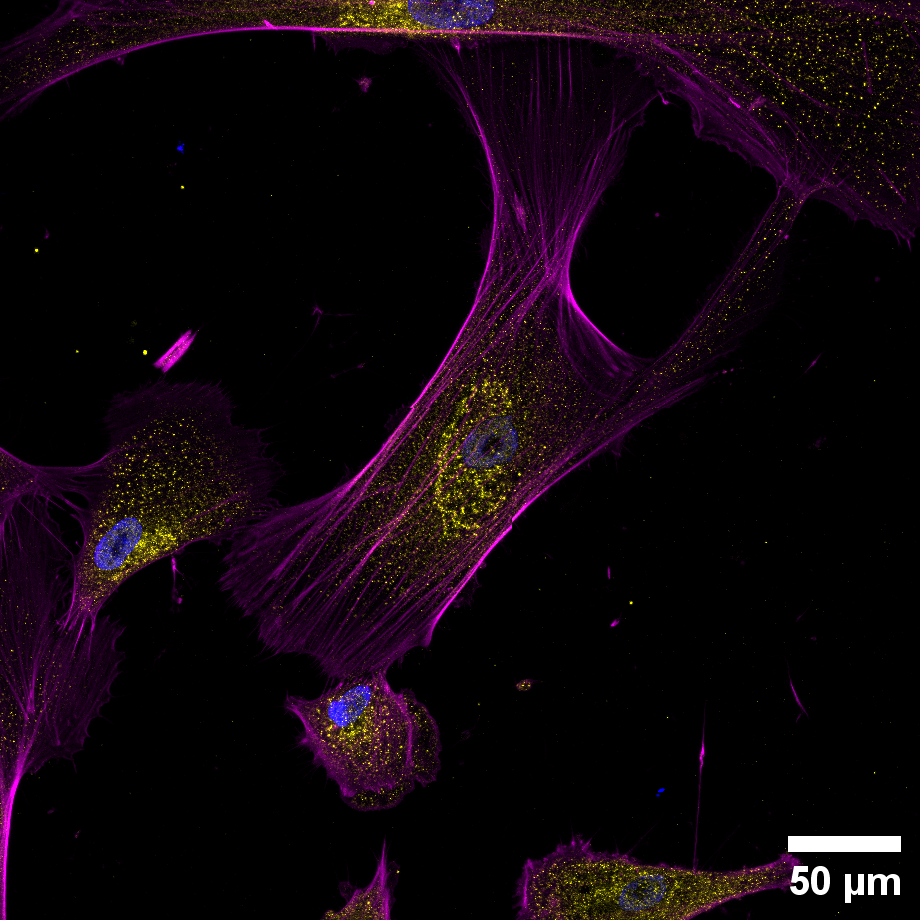 iPSC_Podocytes